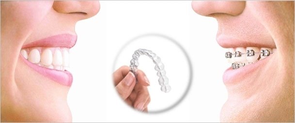 invisalign lleida tarragona